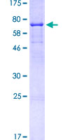 12.5% SDS-PAGE Stained with Coomassie Blue.